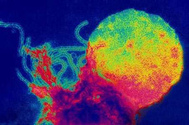 Đã tìm ra thuốc chống bệnh sởi hiệu quả