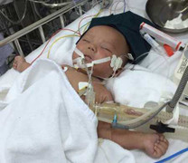 Bộ Y tế được, mất gì khi công bố dịch sởi?