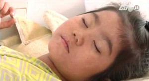 Gia tăng bệnh nhân sởi ở TP.HCM