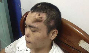 Những phương pháp cấy ghép ‘siêu độc’ trong y học