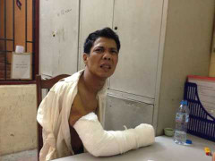 Màn trốn chạy bằng dao của kẻ côn đồ tấn công cảnh sát