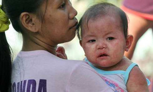 Cộng đồng mạng cùng 'gồng mình' chống dịch sởi