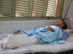 Đâm nát chân cụ già rồi mặc cả bồi thường