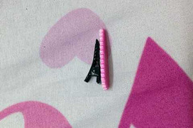 Bé gái thoát nạn hy hữu sau 2 ngày nuốt kẹp tóc