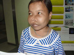 Cảm thương cô gái không thể lớn, mặt biến dạng