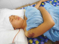 Sinh con được 9 ngày bị bố chồng chém 10 nhát