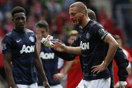 Vidic máu me đầm đìa trong trận đấu cuối cùng Man Utd