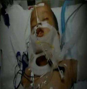 Rơi từ tầng 11, bé 15 tháng tuổi sống sót kỳ diệu