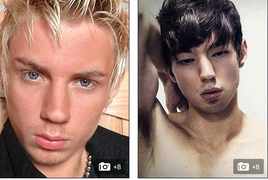 Phẫu thuật đau đớn biến người mắt xanh thành mắt đen