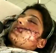 Đau lòng cô gái xinh đẹp bị bắn, ném xuống mương