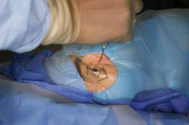 5 tai nạn nghề nghiệp kinh hoàng nhất ngành y