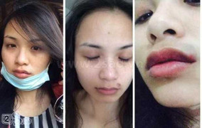 Những nhan sắc Việt 'bầm dập' dưới tay người tình