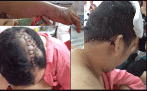 Chủ quán karaoke bị giang hồ truy sát dã man