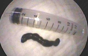 Đỉa bò ngoe nguẩy trong bim bim nghi của Trung Quốc