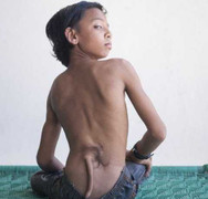 'Thánh' có đuôi ở Ấn Độ: Muốn đi phải cắt bỏ đuôi