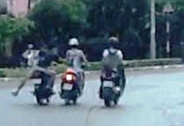 Một phụ nữ bị cướp giật, ngã chấn thương sọ não