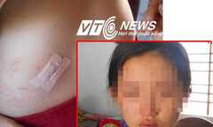 Chạy xe đường vắng, nữ sinh bị hãm hiếp