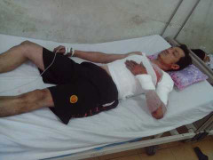 Lò thép nổ tung như pháo hoa: Nạn nhân kể thời khắc kinh hoàng