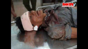 Clip: Trộm chó bị trăm người đánh 'bán sống bán chết'