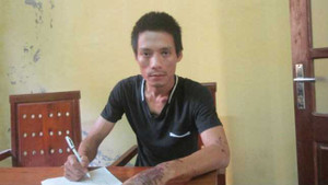 Bị 'cắm sừng', một ca sỹ dạy vợ bằng axit