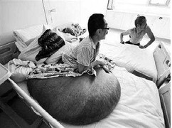 Khối u nặng hơn 100 kg làm biến dạng con người