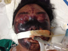 Xem video này không ai còn dám ăn tiết canh!