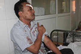 Xe khách đối đầu xe tải: Danh sách 20 nạn nhân cấp cứu