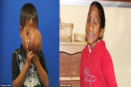 'Bàn tay vàng' cứu số phận 1 con người thế nào?