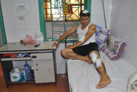 Đi làm về khuya, bị giang hồ chém tới tấp