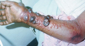 Thế giới 24h: Ebola 'khát máu' đang đe dọa loài người