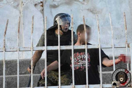 Manh động chống cảnh sát, fan cuồng mất cả bàn tay