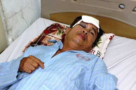 Công an xã bị 'cẩu tặc' chém thẳng trán