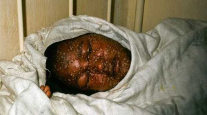 Thực hư lời tiên tri về đại dịch Ebola đe doạ thế giới của Vanga