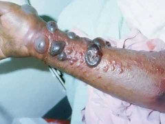 Bí ẩn nguồn gốc và sự tàn khốc của Ebola