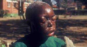 Video: Tốc độ lây lan kinh hoàng của dịch Ebola