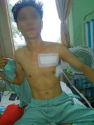 Đâm thấu ngực hàng xóm vì hát karaoke gây ồn ào