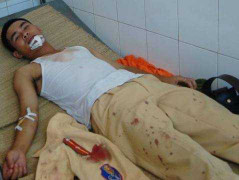 Côn đồ hung hãn dùng dao bầu chém vào mặt CSGT