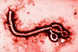 Xà phòng tiêu diệt được virus Ebola