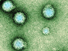 Thêm 1 loại virus lạ nguy hiểm chết người