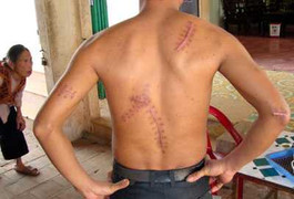 Chém người vì nghi ngờ ném đá… để quậy phá