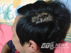 Giang hồ xông vào nhà chém người giữa ban ngày