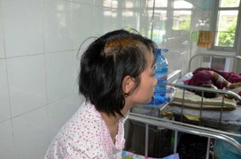 Bắt giam 'cha dượng' chém nứt sọ bé 15 tuổi