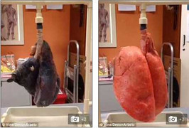 Cận cảnh lá phổi bị tàn phá khủng khiếp