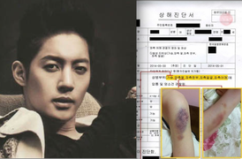 Bạn gái cũ Kim Hyun Joong tung ảnh thương tích đầy mình