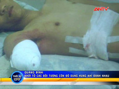 Clip: Sẵn hơi men, nhóm côn đồ dùng dao hỗn chiến