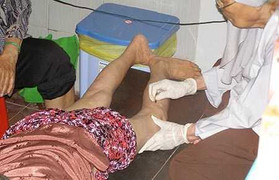 Phẫu thuật nhân đạo: Có chuyện lạm dụng tiền từ thiện