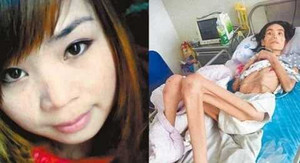 Bị mẹ chồng bỏ đói, từ hotgirl thành xác khô