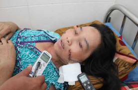 Nghi chồng 'tòm tem', vợ lấy dao lao rạch mặt hàng xóm