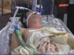 Vụ ngạt khí ở quán karaoke: Nạn nhân đầu tiên hồi tỉnh