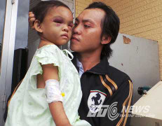 Bé 4 tuổi bị hành hạ dã man: Cha đẻ bất ngờ xuất hiện